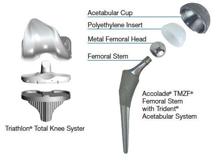Recent Advances in Total Joint Replacement